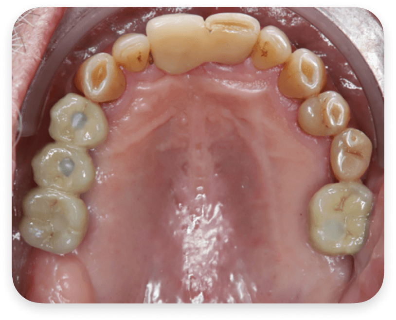 Suivi Patient Individualisé & Bien-être Mental - After