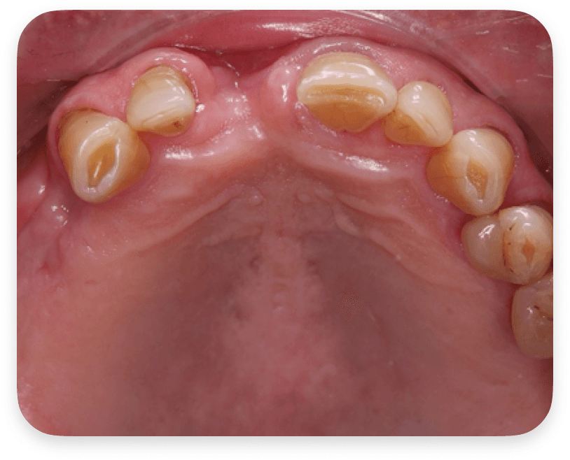 Suivi Patient Individualisé & Bien-être Mental - Before