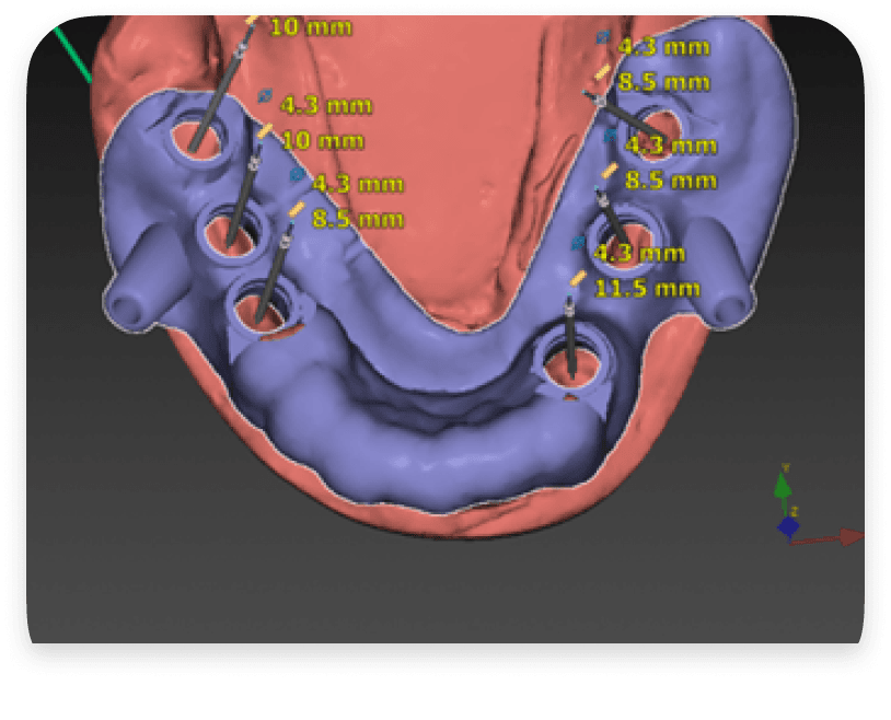 Techniques Chirurgicales Innovantes & Technologies - After