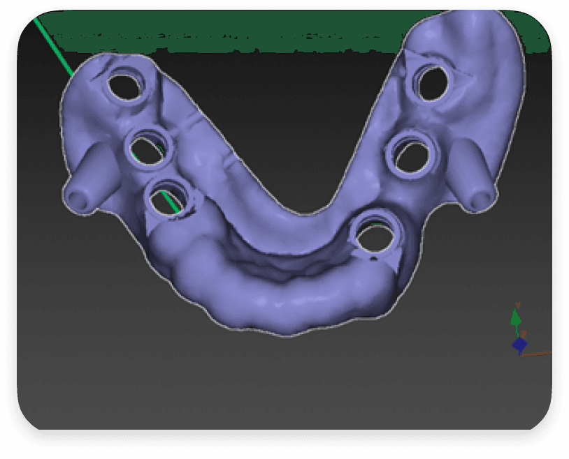 Techniques Chirurgicales Innovantes & Technologies - Before
