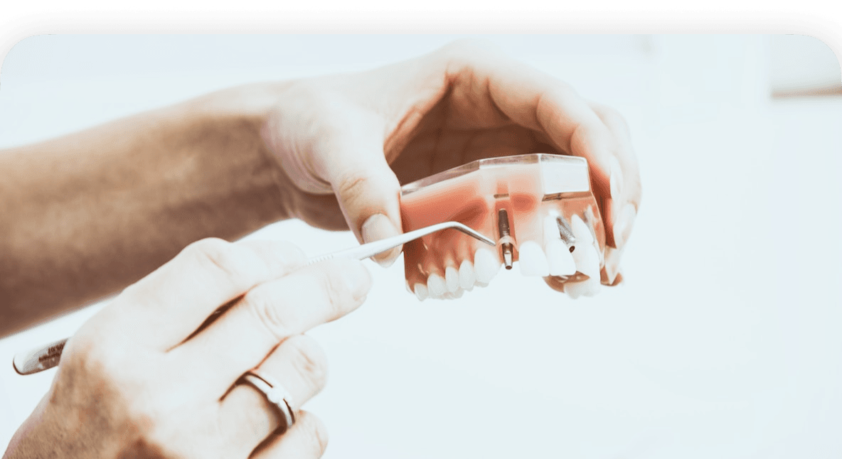 Techniques Parodontales